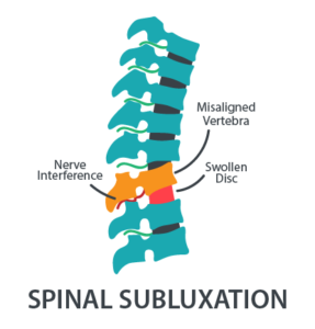 Spinal Subluxation