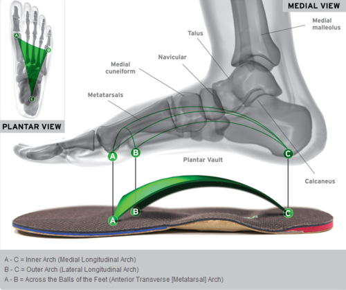 Custom Foot Orthotics